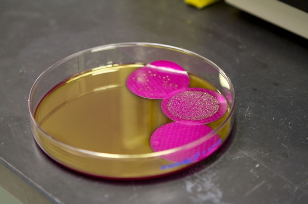 Coliform bacteria plate grows E. coli on selective differential media.