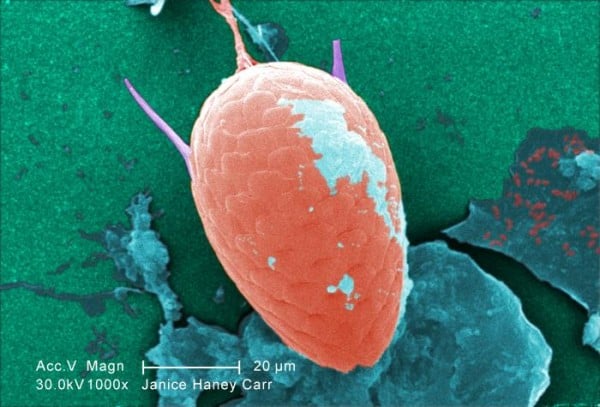 Is giardia found in well water Pinworm férgek terhesség alatt történő kezelés során